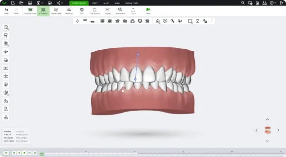 SmileInspector application window with a segmented upper and lower arch ready for planning