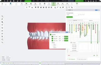 SmileInspector aligner workflow for dental labs