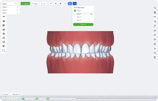 SmileInspector aligner workflow for general practitioners