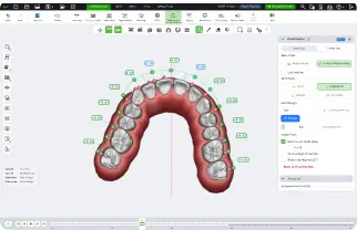 SmileInspector aligner workflow for orthodontists