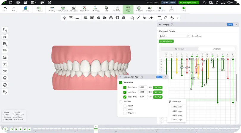 Staging timeline interface
