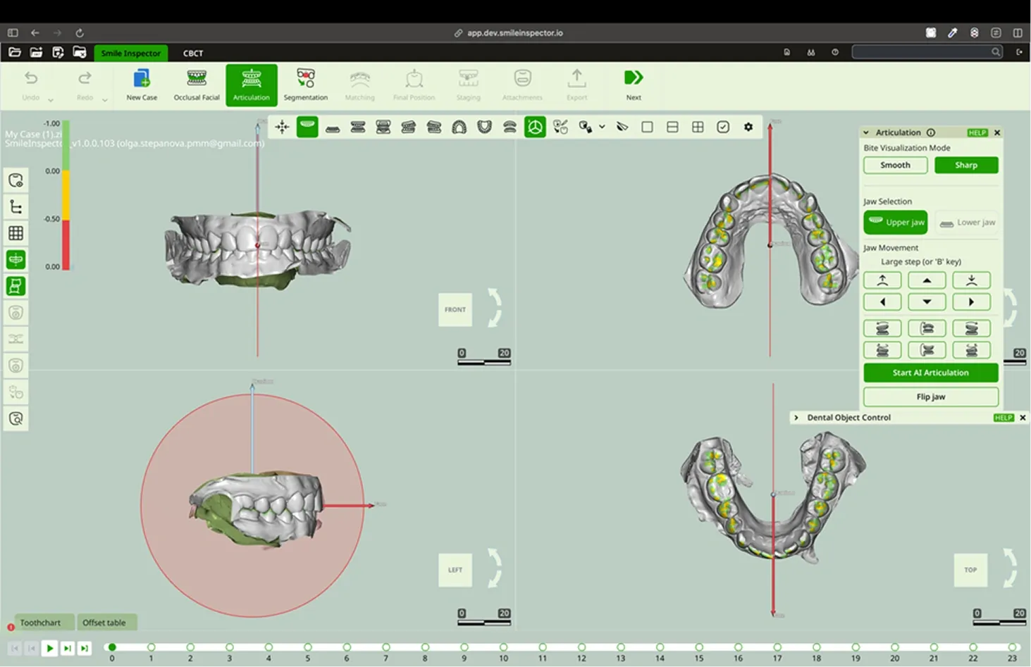 Aligning upper and lower jaws in occlusion