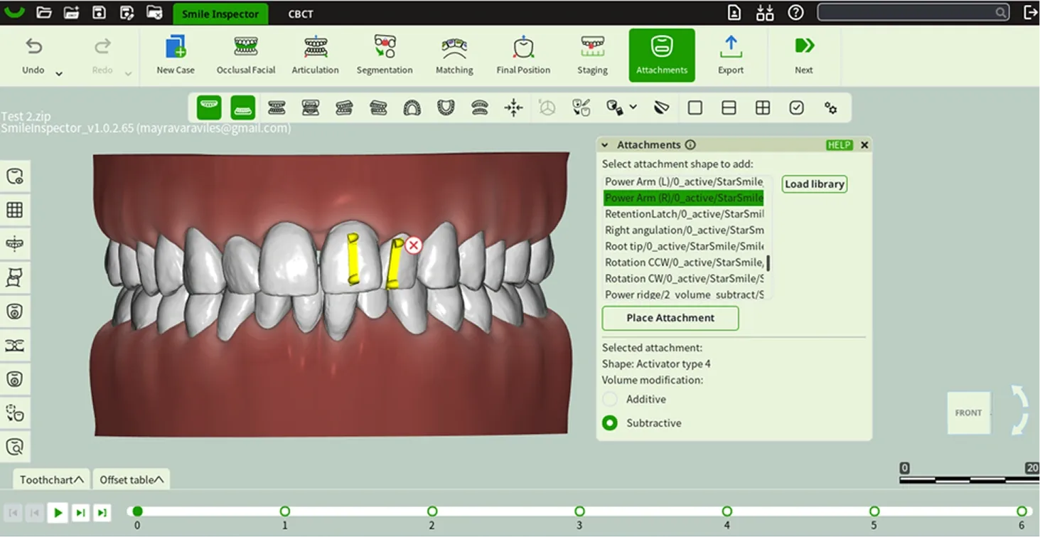 What: Add movement-supporting attachments.How: