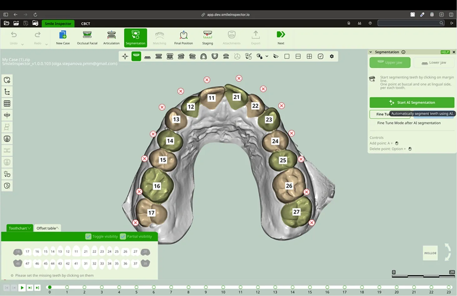 Separate individual teeth