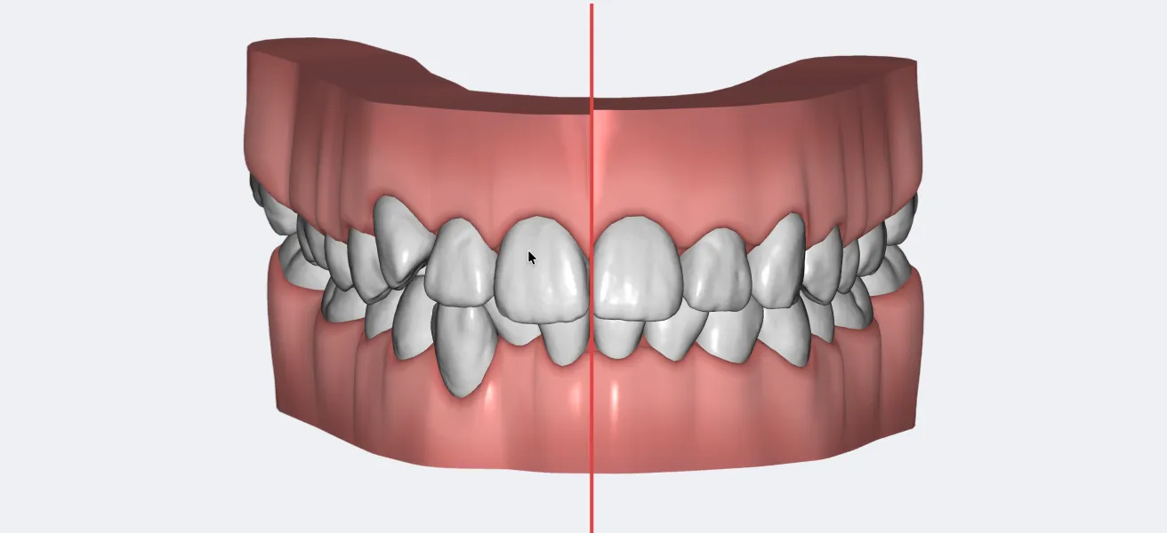 An AI-proposed final position: the original crowding on the left of the midline, the planned result on the right.