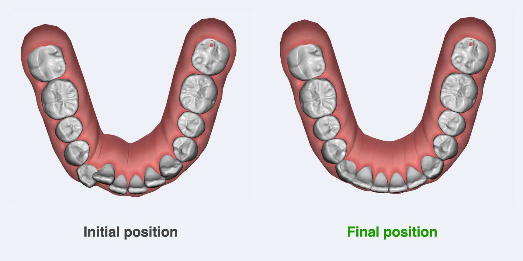 An AI-proposed final position: the original crowding on the left of the midline, the planned result on the right.