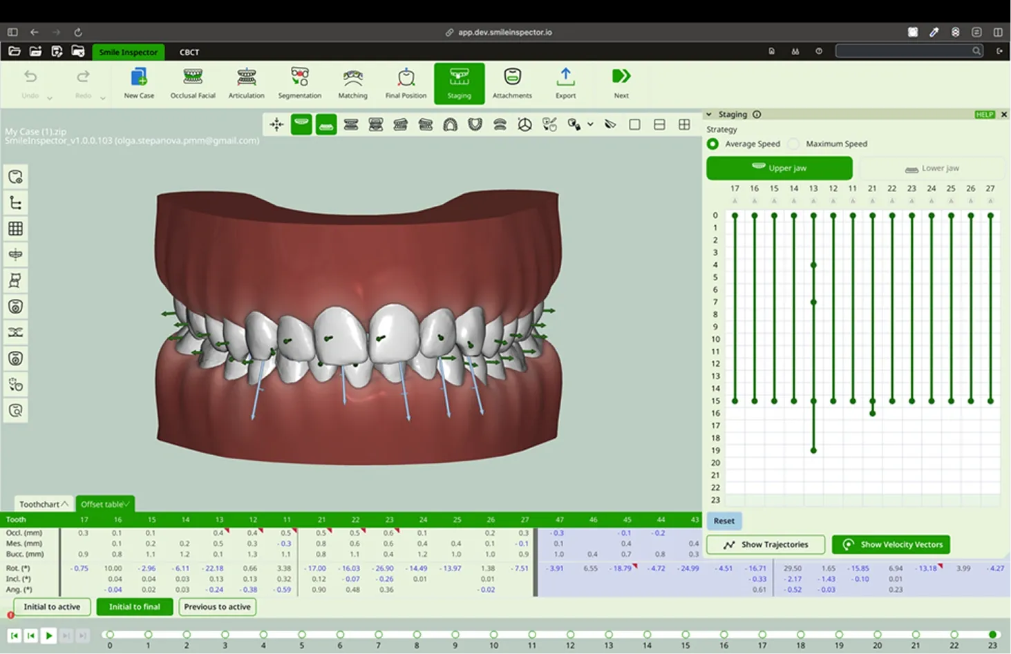 Average Speed: All the teeth will move at the same speed throughout all stages.