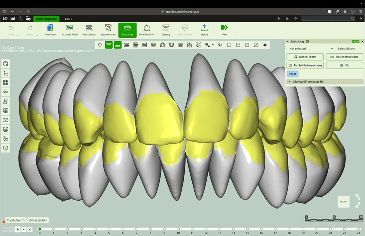 In the Manual IP Contacts Fix section, you can adjust the contacts individually between each selected tooth