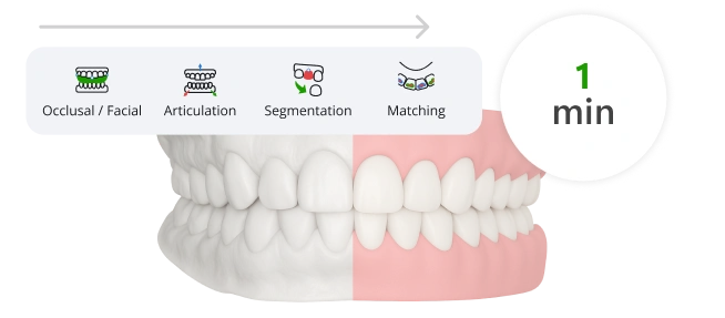 SmileInspector auto-segmenting an intraoral scan into individual teeth