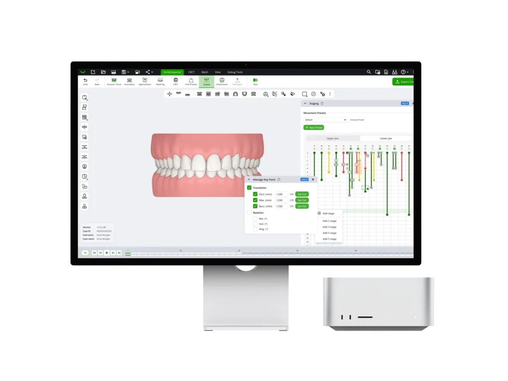 SmileInspector Portal open on a desktop showing a staged treatment timeline