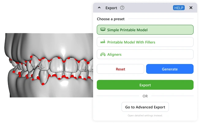 Exported aligner STL model with an automatically generated trimline