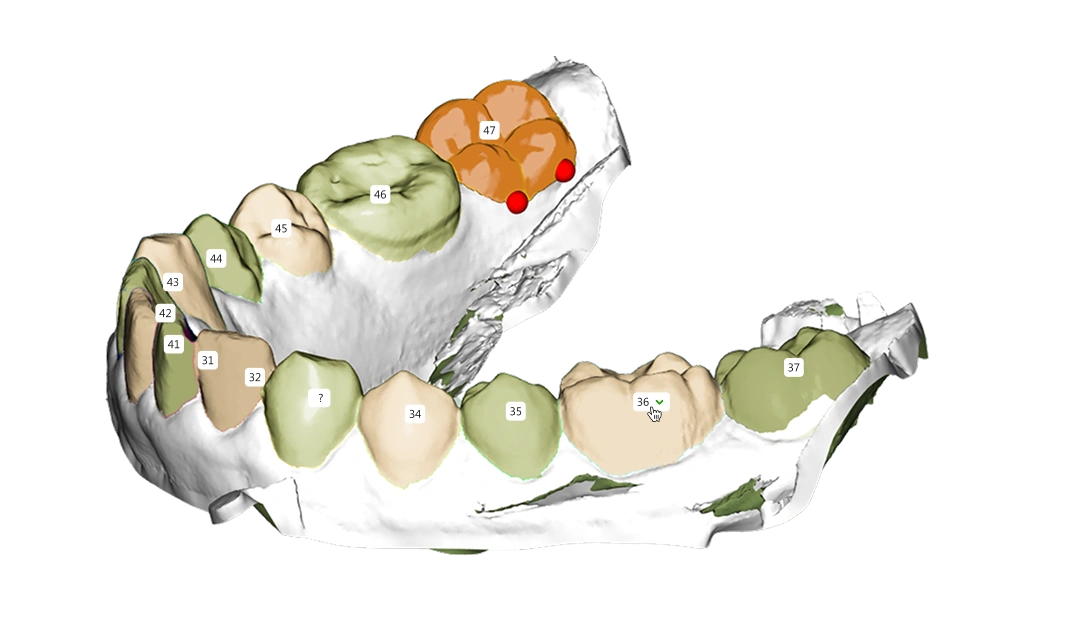AI Tooth Segmentation