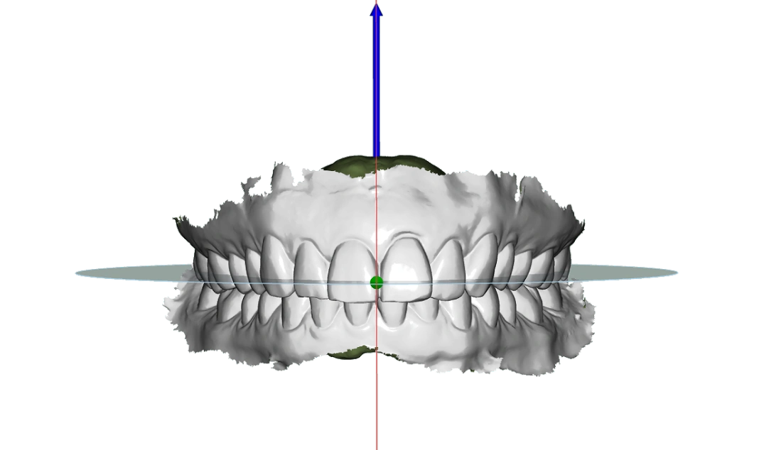 Occlusal & Mid-Plane Setup