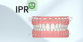 Setting up the Final Position in SmileInspector