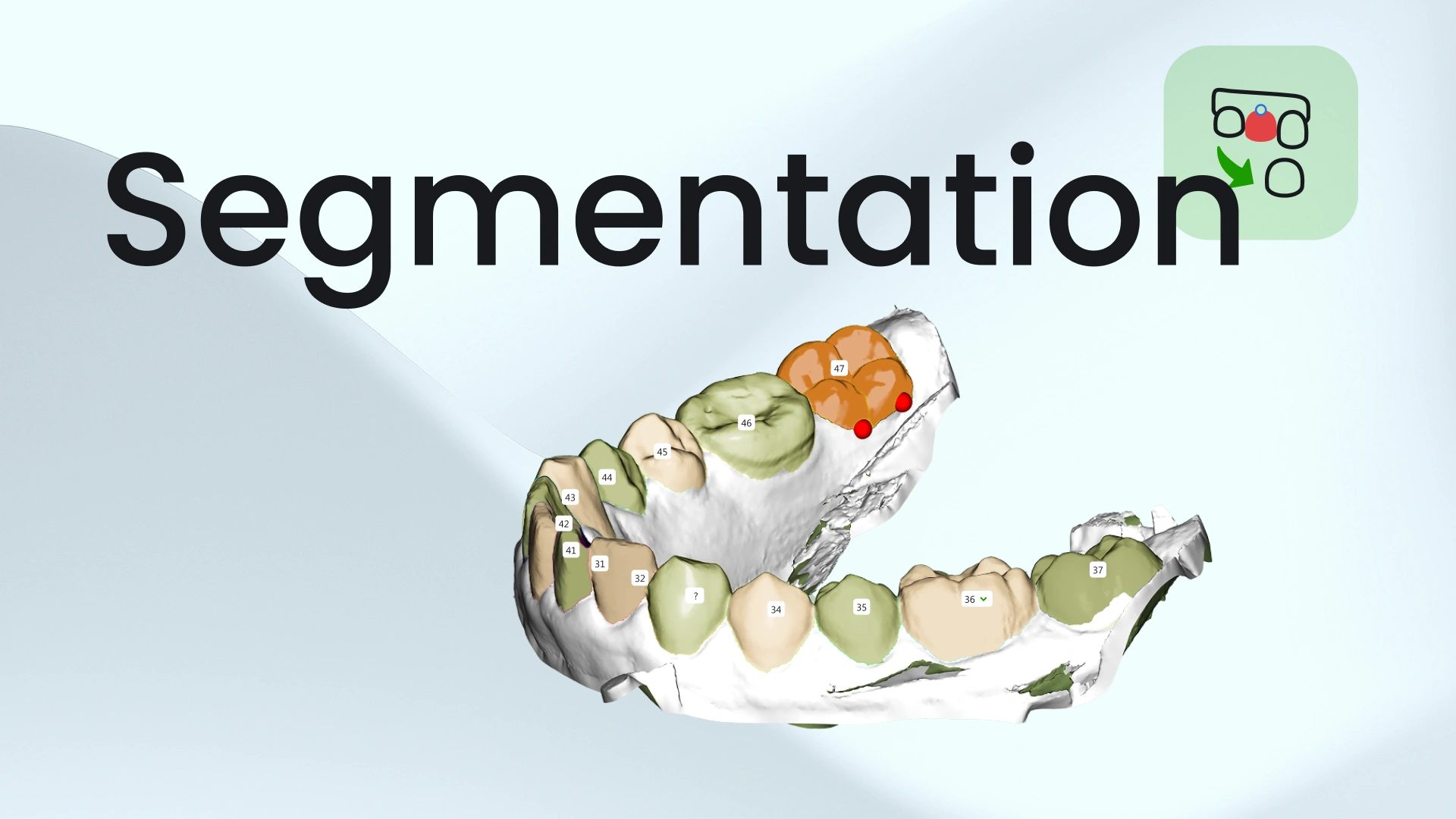 Segmenting Teeth crowns in SmileInspector
