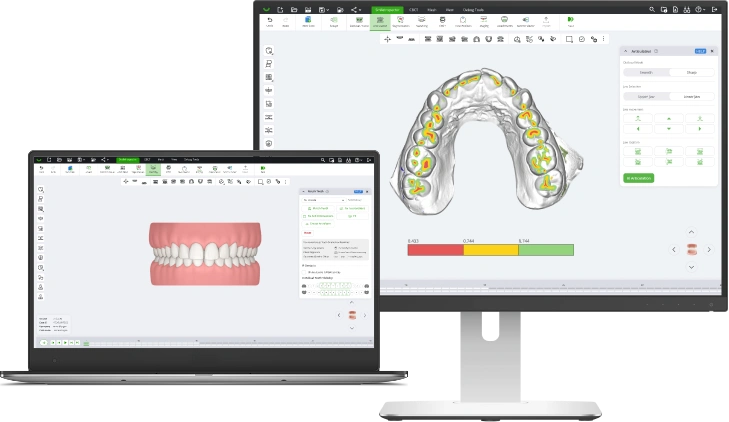 SmileInspector application shown on a laptop and a monitor