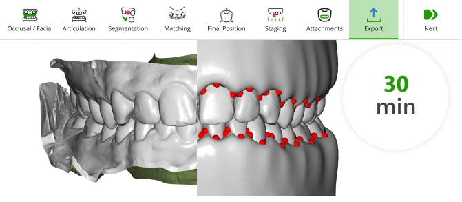 Complete treatment plan in under 30 minutes