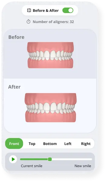 Patient Viewer treatment plan shown on a phone